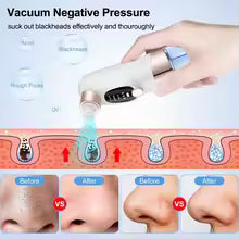 Blackhead Remover Pore Vacuum Cleaner Multifunctional Cleaning Instrument Small Bubble Facial Cleasing Machine Beauty Device